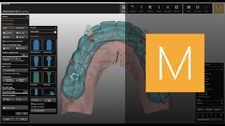 Bars module of ZirkonzahnModellier  ZirkonzahnSoftware [upl. by Alba199]