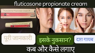 fluticasone propionate cream ip uses in hindi  daag dhabbe hatane ki cream bina side effect  face [upl. by Okire175]