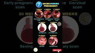 Types Of Scans During Pregnancy baby scanning scan pregnancy shortsvideo ytshorts [upl. by Kuo]