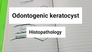 Odontogenic keratocyst Histopathology [upl. by Bashemath]