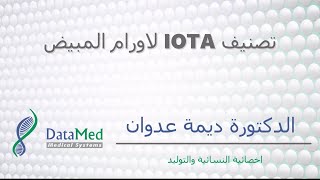 محاضرة الدكتورة ديمة عدوان تصنيف IOTA الاورام المبيض [upl. by Hellah]