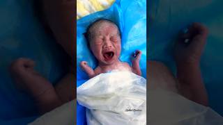 New Born 👶 newborn neonatal baby babycrying babies shorts satisfying [upl. by Allen]