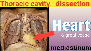 Heart dissection ❤ real human body Mediastinum thoracic cavity anatomy internal organs [upl. by De Witt]