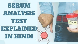 SEMEN ANALYSIS Part 1semen analysissemen testsex test procedure of semen analysisscience [upl. by Yarled]