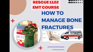 How to manage Bone fractures RescueTrainingCourseRescue1122TrainingCourse [upl. by Vani]