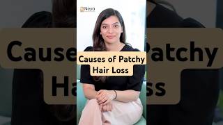 Cause of patchy hair loss  Alopecia Areata  Hair Fall Treatment in Hyderabad shorts [upl. by Wixted]