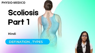 Scoliosis  Definition  Types  Physiotherapy  Notes  Hindi  Back Pain Reason  Hindi  Lecture [upl. by Meehsar523]