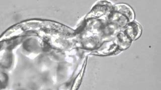 Biopsia de Blastocistowmv Dr Roberto Coco [upl. by Adnilab389]