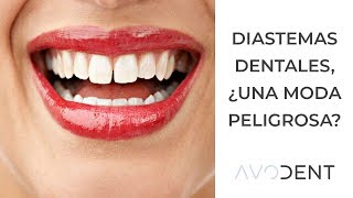 Diastemas ¿cómo corregir los dientes separados  Clínica dental Avodent en Alcobendas [upl. by Guyer917]