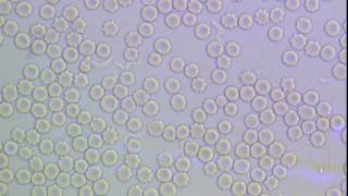 Trypanosoma brucei in mammalian blood [upl. by Cutlerr]