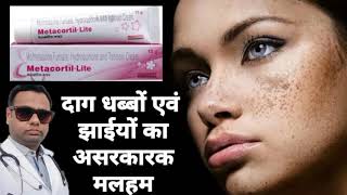 Ointment for melasma। Metacortil ointment review Hydroquinone Tretinoin amp Mometasone cream। uses। [upl. by Vharat]