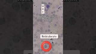 How to do microscopy and calculate reticulocyte count Reticulocyte count Part 2 [upl. by Tali486]