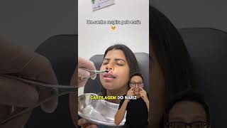 Desvio de Septo Nasal 😱medicina medico otorrinolaringologia cirurgiaplastica splinter nariz [upl. by Yruam]