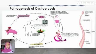 Cysticercosis [upl. by Jaffe]