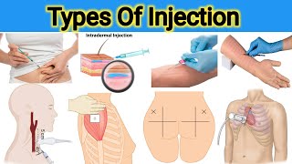 Types of Injections  Injections Sites Route Angle amp Techniques [upl. by Lekym]