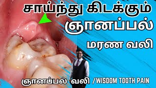 ஞானப்பல் வலி குறைய2024𝐖𝐢𝐬𝐝𝐨𝐦 𝐭𝐨𝐨𝐭𝐡 𝐏𝐚𝐢𝐧 𝐢𝐧 𝐓𝐚𝐦𝐢𝐥Tooth pain relief in tamilkadava pallu pain [upl. by Nahsor]