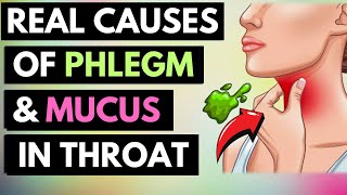 The Real Causes of Constant PHLEGM amp MUCUS In Your Throat [upl. by Esom]