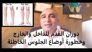 دوران القدم للداخل والخارج وخطورة أوضاع الجلوس الخاطئة intoing gait [upl. by Thatch]