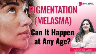 Cause of Skin Pigmentation  Best Treatment of Pigmentation  Soul Derma clinic Soul Derma Clinic [upl. by Orin]