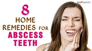 8 Home Remedies for Abscess Teeth [upl. by Belldas914]