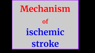 Mechanism of ischemic stroke [upl. by Eelatsyrc]