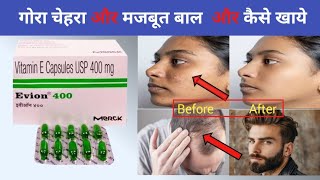 Evion 400 capsule uses in Hindi  Evion 400 capsule  Vitamin E capsule [upl. by Kresic]