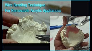 Wire Bending Technique for Removable Acrylic Appliances [upl. by Aidnahs]