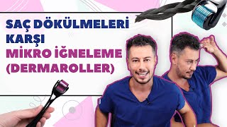 Saç Dökülmeleri Karşı Mikro İğneleme Dermaroller [upl. by Mafalda71]