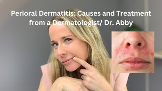 Perioral dermatitis causes and treatment from a Dermatologist [upl. by Varin]