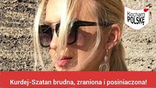 KurdejSzatan brudna zraniona i posiniaczona Co się dzieje [upl. by Schild]