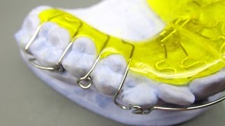 Herstellung einer Dehnplatte KFO Kieferorthopädie Orthodontics active plate Labial Bow Adams clasp [upl. by Sutherlan]