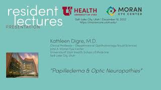 Papilledema amp Optic Neuropathies [upl. by Kristi]