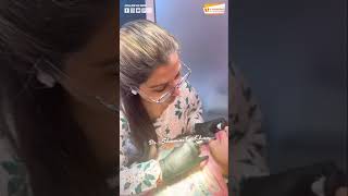 Lip Fillers in Islamabad by Dr Shumaila Khan [upl. by Anekahs195]