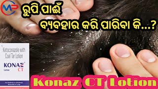 ରୁପି ପାଈଁ ବ୍ଯବହାର କରିବା Konaz CT Lotion Uses for Dandruff Psoriasis Skin infection Allergies Re [upl. by Newell]