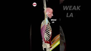 Weak latissimus dorsi strengthtraining [upl. by Litnahs281]