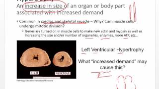 Pathophysiology  Cell stress and injury Ch2 [upl. by Alakim]