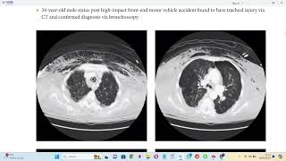 EMERGENCY RADIOLOGY OXFORD [upl. by Karlens]