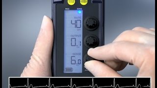 Sensing and Threshold Test — 53401 Temporary Pacemaker [upl. by Zevahc]