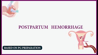 postpartum haemorrhage  NEET PG [upl. by Rolandson]