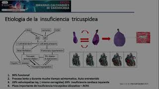 XXXIII Jornadas Calchaquíes Terapéutica Endovascular con el Dr Fava el Dr Alonso y la Dra Akoadd [upl. by Kendyl757]