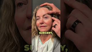 PREOP CHAT WITH SUZANNE 63 PT 1 plasticsurgery [upl. by Netloc]