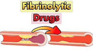 Fibrinolytic Drugs Thrombolytics Mechanism of Action Therapeutic Uses and Adverse Effects [upl. by Acceber976]