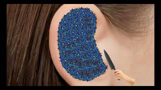 Itchy  Ear Stone Removal  Super Big Earwax  ASMR Animation TalesOfTingles [upl. by Gnehp]