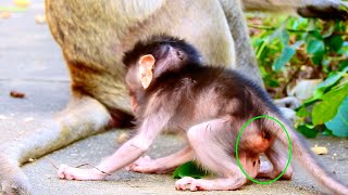 Newborn diarrhea So weAk newborn baby 1 day old [upl. by Ynnor]