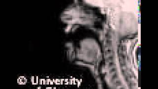 MRI voiceless labiodental fricative [upl. by Yvaht]