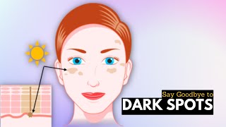 Say Goodbye To Dark Spots On Your Face With These Tips And Tricks [upl. by Steffy200]