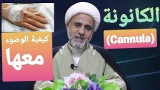 ماحكم الكانونة في اليدالوضوء ام التيمم  ام كلاهما معا [upl. by Anib]