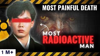 Man Who Died The Most Painful Death ☢️  Horrifying 83 Days  Radiation Disaster [upl. by Nedda725]