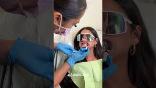 teeth whitening process 🦷 teeth whiting torontoteethwhitening [upl. by Tnarb163]