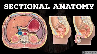 Sectional Anatomy  Abdomen  Pelvis  Anatomy Decoded [upl. by Debera]